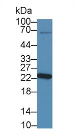 NME5 Antibody in Western Blot (WB)