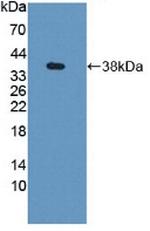 GBP4 Antibody in Western Blot (WB)