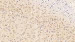 MTCO2 Antibody in Immunohistochemistry (Paraffin) (IHC (P))