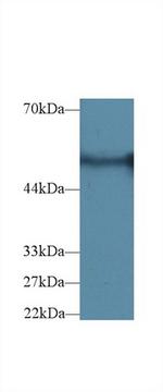 G6PD Antibody in Western Blot (WB)