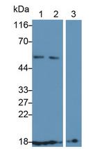 CD59 Antibody in Western Blot (WB)