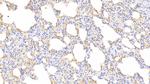 Hemoglobin Antibody in Immunohistochemistry (Paraffin) (IHC (P))