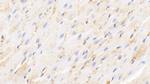 Hemoglobin Antibody in Immunohistochemistry (Paraffin) (IHC (P))