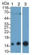 Hemoglobin Antibody in Western Blot (WB)