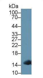 Hemoglobin Antibody in Western Blot (WB)