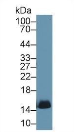 Hemoglobin Antibody in Western Blot (WB)