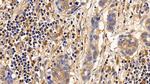 IL13RA2 Antibody in Immunohistochemistry (Paraffin) (IHC (P))