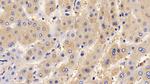 IL13RA2 Antibody in Immunohistochemistry (Paraffin) (IHC (P))