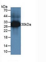 Tryptase Antibody in Western Blot (WB)