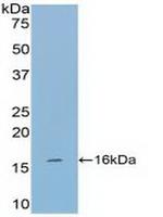 Tryptase Antibody in Western Blot (WB)