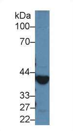 Alcohol Dehydrogenase 1A Antibody in Western Blot (WB)