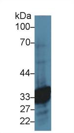 Carbonic Anhydrase VI Antibody in Western Blot (WB)