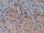 PKC mu Antibody in Immunohistochemistry (Paraffin) (IHC (P))