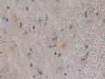 PKC mu Antibody in Immunohistochemistry (Paraffin) (IHC (P))