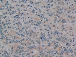 PKC mu Antibody in Immunohistochemistry (Paraffin) (IHC (P))