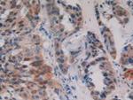 PKC mu Antibody in Immunohistochemistry (Paraffin) (IHC (P))