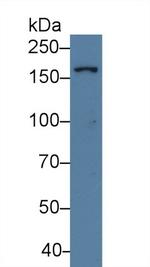 UGGT1 Antibody in Western Blot (WB)