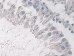 PDE4B Antibody in Immunohistochemistry (Paraffin) (IHC (P))