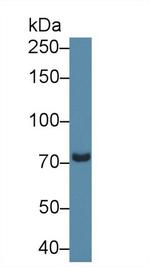 PDE4B Antibody in Western Blot (WB)