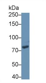 PDE4B Antibody in Western Blot (WB)