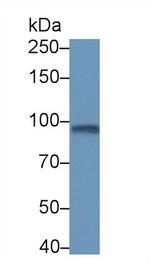 PDE4B Antibody in Western Blot (WB)