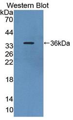 PDE4B Antibody in Western Blot (WB)