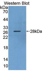 KPNA3 Antibody in Western Blot (WB)