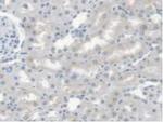 CES1 Antibody in Immunohistochemistry (Paraffin) (IHC (P))