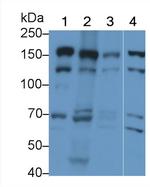 PEX1 Antibody in Western Blot (WB)