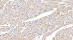 SEMA5B Antibody in Immunohistochemistry (Paraffin) (IHC (P))