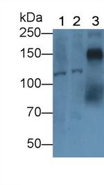 SEMA5B Antibody in Western Blot (WB)