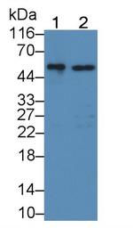 GBA Antibody in Western Blot (WB)