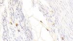 Tryptase Antibody in Immunohistochemistry (Paraffin) (IHC (P))