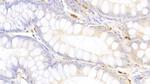 Tryptase Antibody in Immunohistochemistry (Paraffin) (IHC (P))