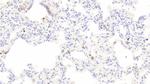 Tryptase Antibody in Immunohistochemistry (Paraffin) (IHC (P))