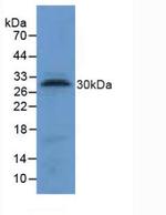 Tryptase Antibody in Western Blot (WB)