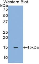 Tryptase Antibody in Western Blot (WB)