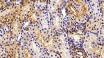 Fibrinogen Antibody in Immunohistochemistry (Paraffin) (IHC (P))