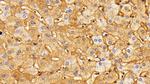 Fibrinogen Antibody in Immunohistochemistry (Paraffin) (IHC (P))