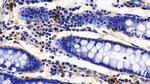 Tryptase Antibody in Immunohistochemistry (Paraffin) (IHC (P))