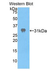 APAF1 Antibody in Western Blot (WB)