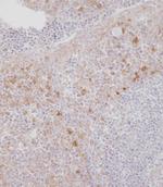 CSF1R Antibody in Immunohistochemistry (Paraffin) (IHC (P))