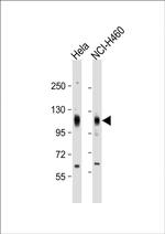 EphA4 Antibody in Western Blot (WB)