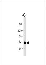 PCSK2 Antibody in Western Blot (WB)