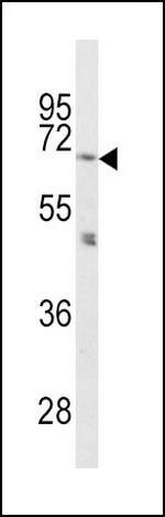 PCSK2 Antibody in Western Blot (WB)