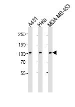 EphB1 Antibody in Western Blot (WB)