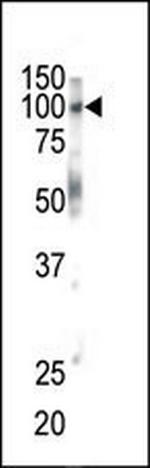 EphB1 Antibody in Western Blot (WB)