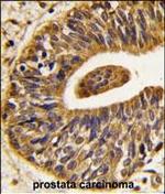 ErbB2 (HER-2) Antibody in Immunohistochemistry (Paraffin) (IHC (P))