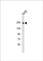 ErbB2 (HER-2) Antibody in Western Blot (WB)