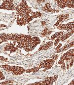 ErbB2 (HER-2) Antibody in Immunohistochemistry (Paraffin) (IHC (P))